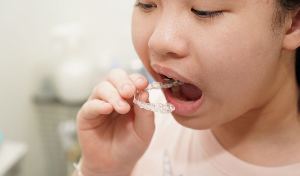 A teenager is holding her teeth braces for teens and is preparing to wear them.