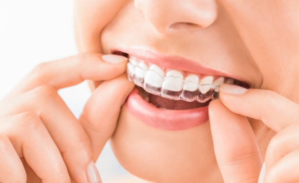 Close-up of a person adjusting her Invisalign near you at one of the best Invisalign dentists near you.