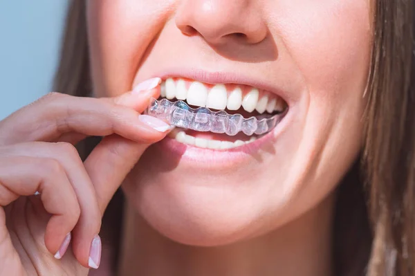 A woman putting in her Invisalign with the question “How does Invisalign work?”, “Is Invisalign worth it?”, and “Does Invisalign hurt?”