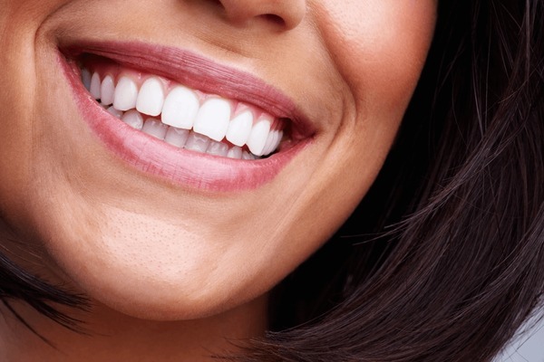 Close-up of a woman smiling after a cosmetic dental treatment with our cosmetic dentist near you.