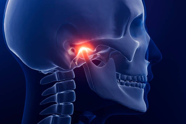 What is TMJ? 3D X-ray image showing inflammation in the temporomandibular joint (TMJ) area. To fully understand Temporomandibular Joint Dysfunction (TMJ) and know when oral and maxillofacial surgery might be needed, it’s important to learn about the three main types of TMJ disorders: