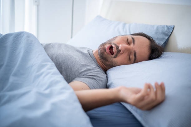 Man sleeping with mouth open, snoring in bed, illustrating sleep apnea.
