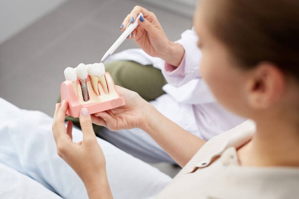 A dental implants price consultation where patients learn their exact price for dental implants.