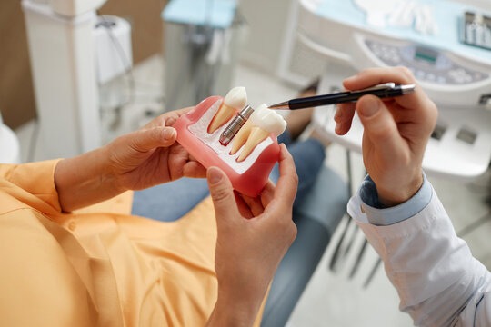 Dentist showing a patient a dental implant model, explaining how the implant, abutment, and crown work as part of the process.